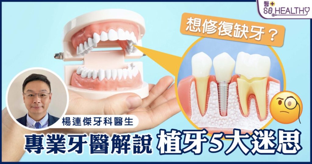 《醫+So healthy》報導：想修復缺牙？專業牙醫解說植牙5大迷思！